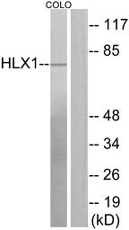 Anti-HLX1 antibody used in Western Blot (WB). GTX87590