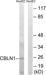 Anti-CBLN1 antibody used in Western Blot (WB). GTX87593