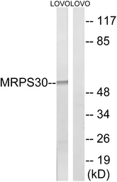 Anti-MRPS30 antibody used in Western Blot (WB). GTX87600