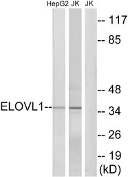 Anti-ELOVL1 antibody used in Western Blot (WB). GTX87606