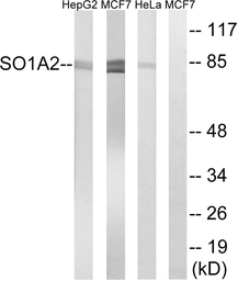 Anti-SLCO1A2 antibody used in Western Blot (WB). GTX87607