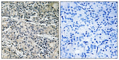 Anti-MP68 antibody used in IHC (Paraffin sections) (IHC-P). GTX87609
