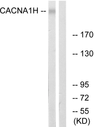 Anti-Cav3.2 antibody used in Western Blot (WB). GTX87612