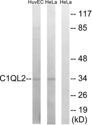 Anti-C1QL2 antibody used in Western Blot (WB). GTX87613