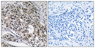 Anti-MRPL13 antibody used in IHC (Paraffin sections) (IHC-P). GTX87614