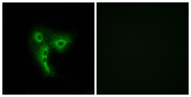 Anti-OR4A4 + OR4A47 antibody used in Immunocytochemistry/ Immunofluorescence (ICC/IF). GTX87617