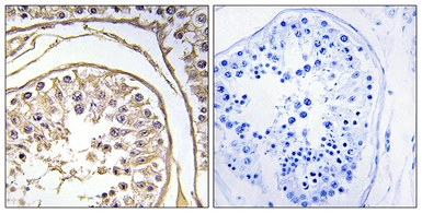 Anti-BAGE2 antibody used in IHC (Paraffin sections) (IHC-P). GTX87618