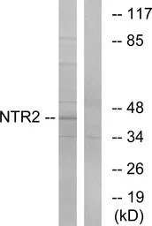 Anti-NTSR2 antibody used in Western Blot (WB). GTX87621