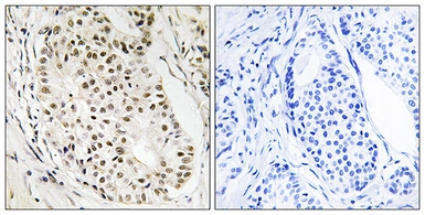 Anti-HNRNPUL2 antibody used in IHC (Paraffin sections) (IHC-P). GTX87623