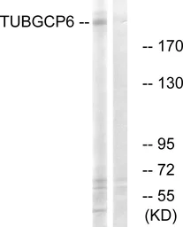 Anti-GCP6 antibody used in Western Blot (WB). GTX87629
