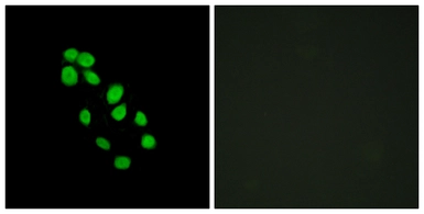 Anti-IRX2 antibody used in Immunocytochemistry/ Immunofluorescence (ICC/IF). GTX87634