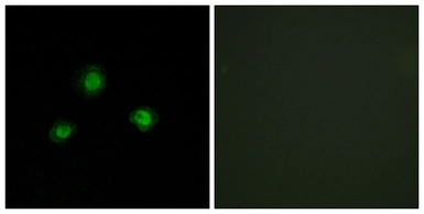 Anti-Ubinuclein 1 antibody used in Immunocytochemistry/ Immunofluorescence (ICC/IF). GTX87636