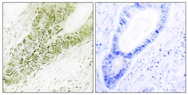 Anti-Ubinuclein 1 antibody used in IHC (Paraffin sections) (IHC-P). GTX87636