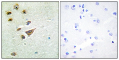 Anti-NT5C3 antibody used in IHC (Paraffin sections) (IHC-P). GTX87639