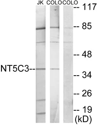 Anti-NT5C3 antibody used in Western Blot (WB). GTX87639