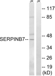 Anti-SerpinB7 antibody used in Western Blot (WB). GTX87640