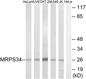 Anti-MRPS34 antibody used in Western Blot (WB). GTX87642