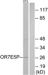 Anti-OR7E5P antibody used in Western Blot (WB). GTX87643