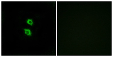 Anti-Arylsulfatase D antibody used in Immunocytochemistry/ Immunofluorescence (ICC/IF). GTX87652