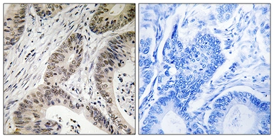 Anti-TUT1 antibody used in IHC (Paraffin sections) (IHC-P). GTX87654