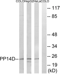Anti-PPP1R14D antibody used in Western Blot (WB). GTX87655