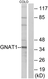 Anti-GNAT1 antibody used in Western Blot (WB). GTX87657