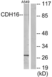Anti-CDH16 antibody used in Western Blot (WB). GTX87660