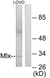 Anti-MLX antibody used in Western Blot (WB). GTX87667