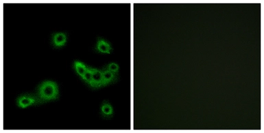 Anti-PEVR2 antibody used in Immunocytochemistry/ Immunofluorescence (ICC/IF). GTX87668