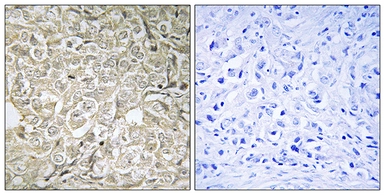 Anti-RAB37 antibody used in IHC (Paraffin sections) (IHC-P). GTX87674
