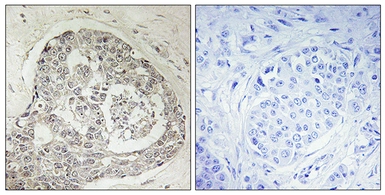 Anti-K0100 antibody used in IHC (Paraffin sections) (IHC-P). GTX87678