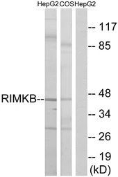 Anti-RIMKB antibody used in Western Blot (WB). GTX87679