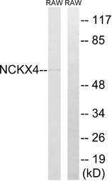 Anti-SLC24A4 antibody used in Western Blot (WB). GTX87682