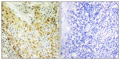 Anti-HIRA antibody used in IHC (Paraffin sections) (IHC-P). GTX87684