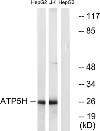 Anti-ATP5H antibody used in Western Blot (WB). GTX87685