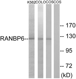 Anti-RANBP6 antibody used in Western Blot (WB). GTX87686