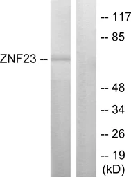 Anti-ZNF23 antibody used in Western Blot (WB). GTX87687