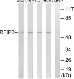 Anti-RAB11FIP2 antibody used in Western Blot (WB). GTX87690