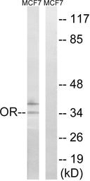 Anti-OR51H1 antibody used in Western Blot (WB). GTX87691