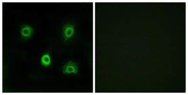 Anti-ABHD6 antibody used in Immunocytochemistry/ Immunofluorescence (ICC/IF). GTX87697