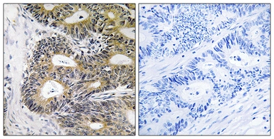 Anti-TRAPPC6A antibody used in IHC (Paraffin sections) (IHC-P). GTX87700