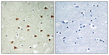 Anti-ABHD14B antibody used in IHC (Paraffin sections) (IHC-P). GTX87706
