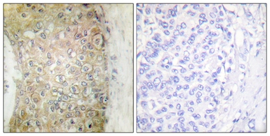 Anti-Hsp20 antibody used in IHC (Paraffin sections) (IHC-P). GTX87716