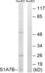 Anti-S100A7L2 antibody used in Western Blot (WB). GTX87717