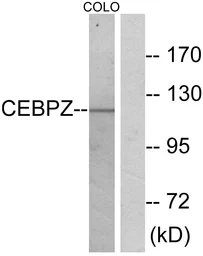 Anti-CBF antibody used in Western Blot (WB). GTX87718