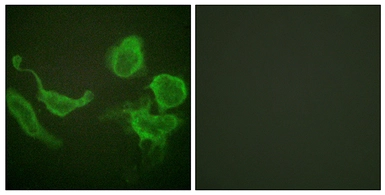 Anti-KCNC4 antibody used in Immunocytochemistry/ Immunofluorescence (ICC/IF). GTX87719