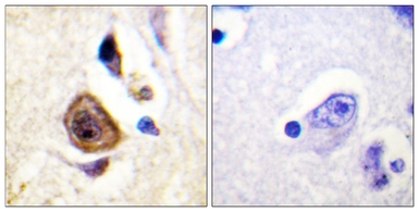 Anti-KCNC4 antibody used in IHC (Paraffin sections) (IHC-P). GTX87719