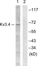Anti-KCNC4 antibody used in Western Blot (WB). GTX87719