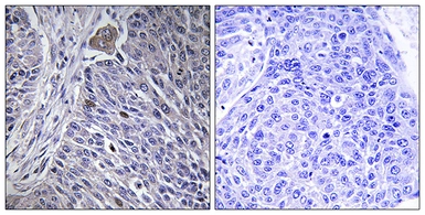 Anti-HNRPDL antibody used in IHC (Paraffin sections) (IHC-P). GTX87722