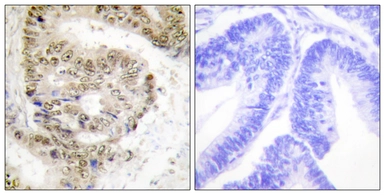 Anti-hnRNP L antibody used in IHC (Paraffin sections) (IHC-P). GTX87723